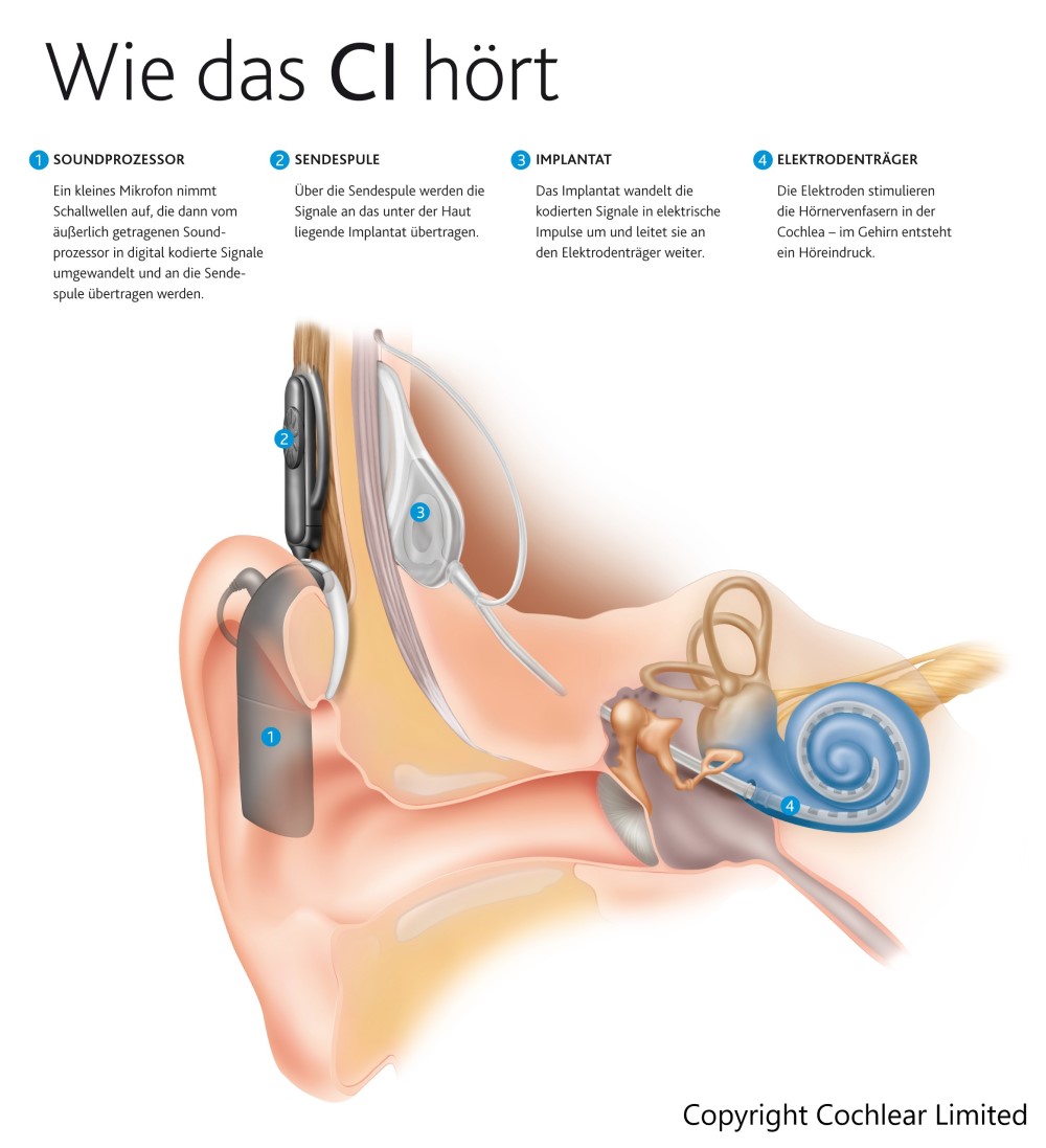 Abb3_Web_mitCopyright_klein Abb3_Web_mitCopyright_klein